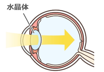 正常な眼